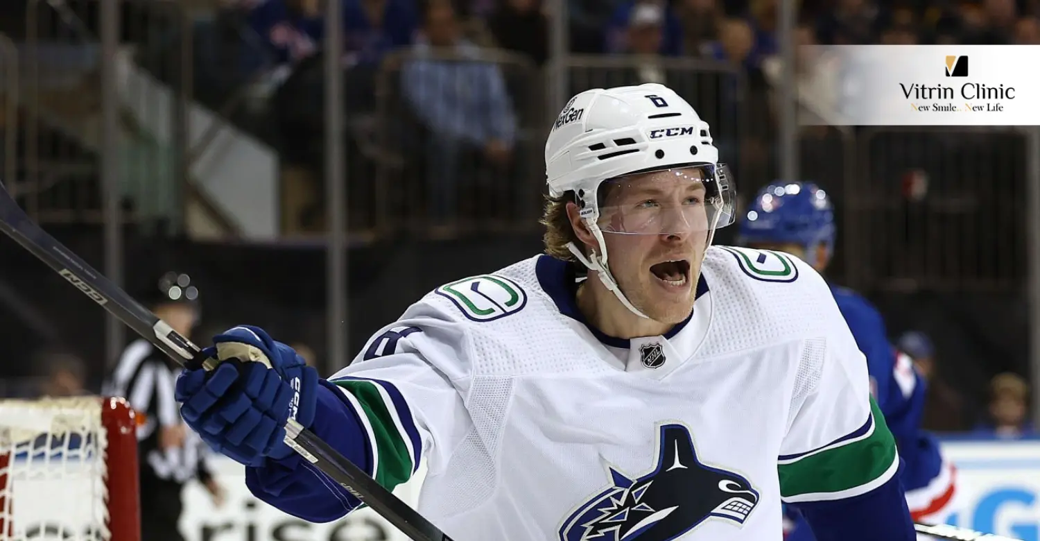 Brock Boeser smile
