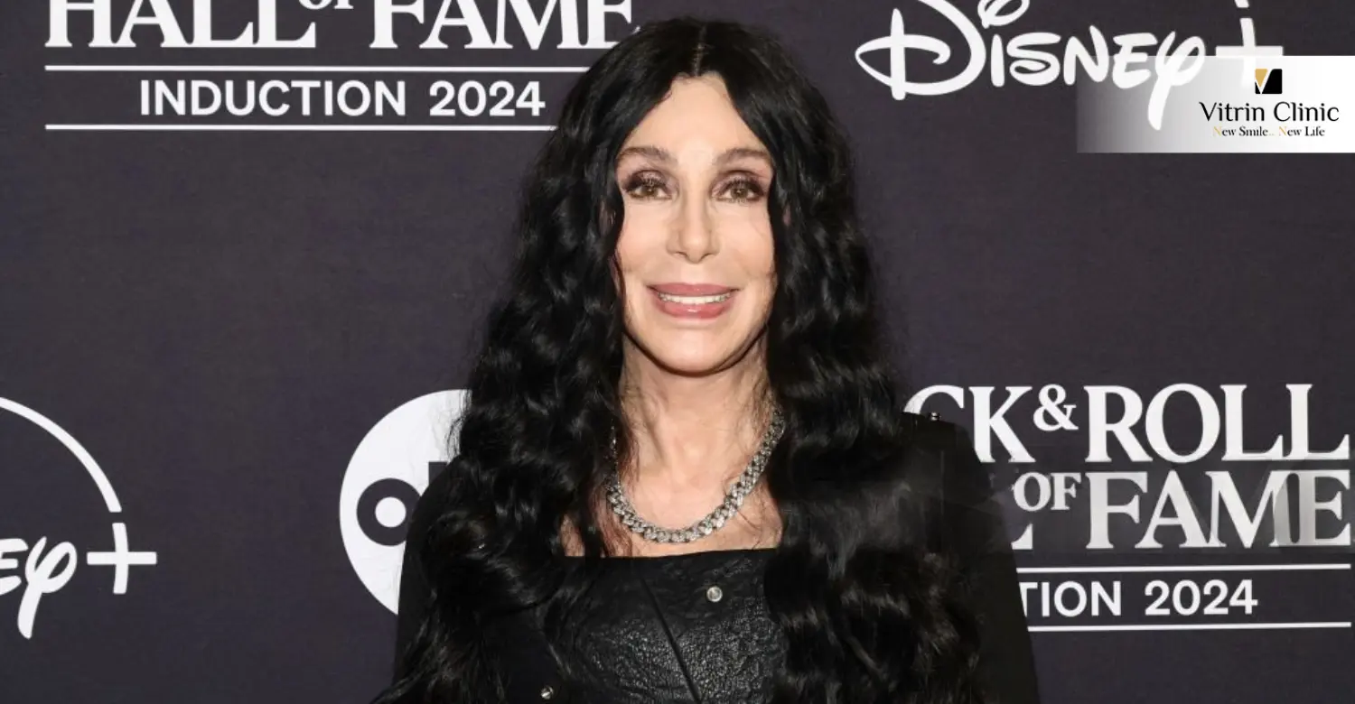 Cher smile