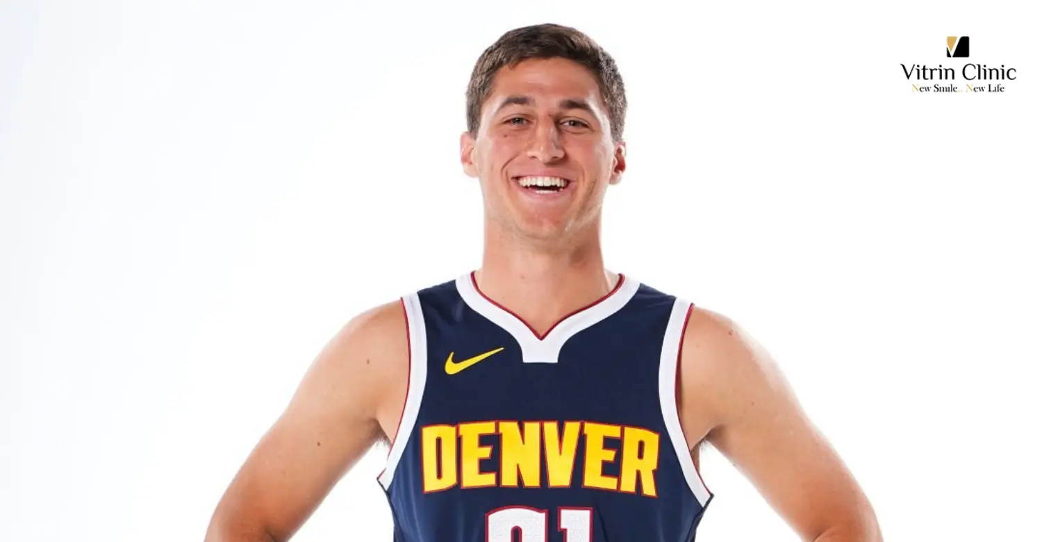 Collin Gillespie Teeth: Inside His Smile Transformation