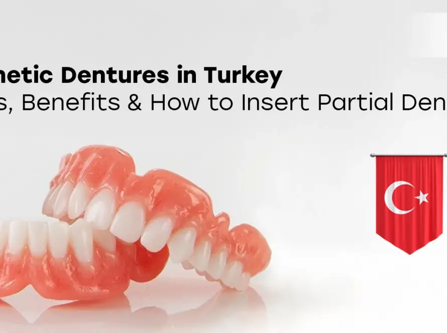 Cosmetic dentures in Turkey