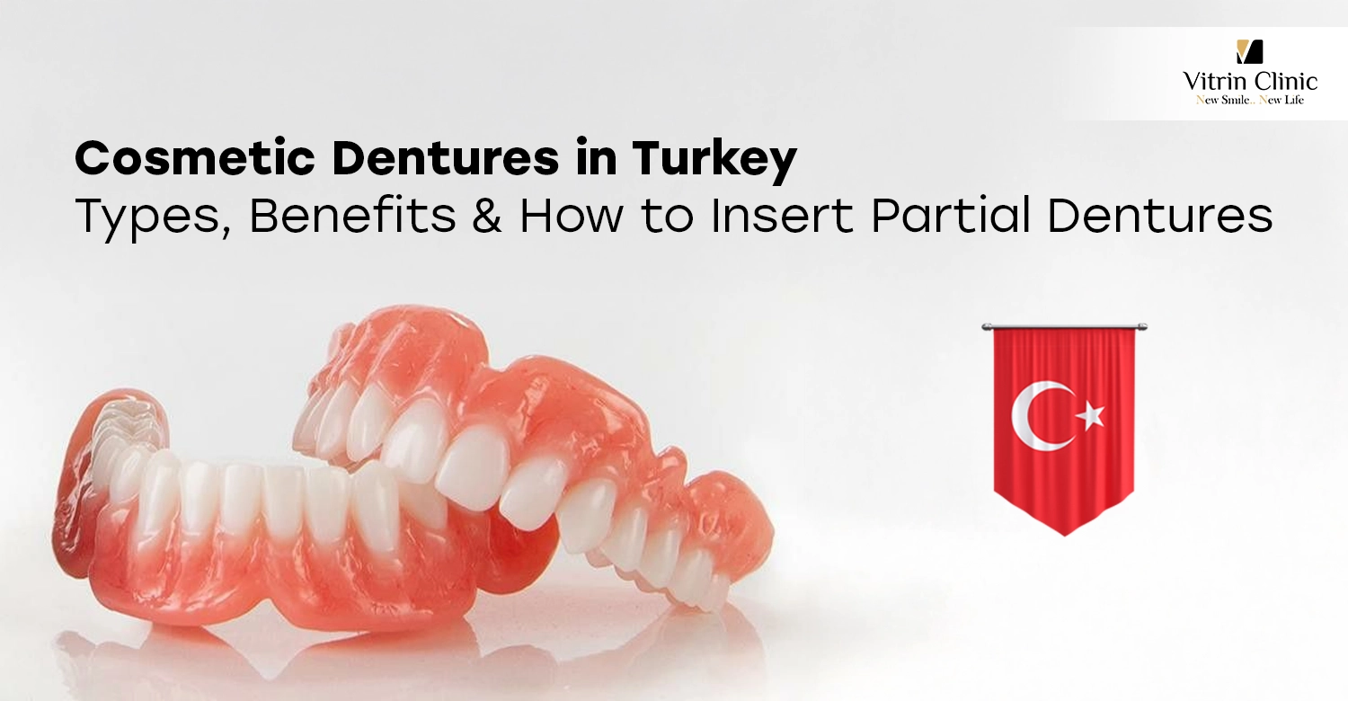 Cosmetic dentures in Turkey