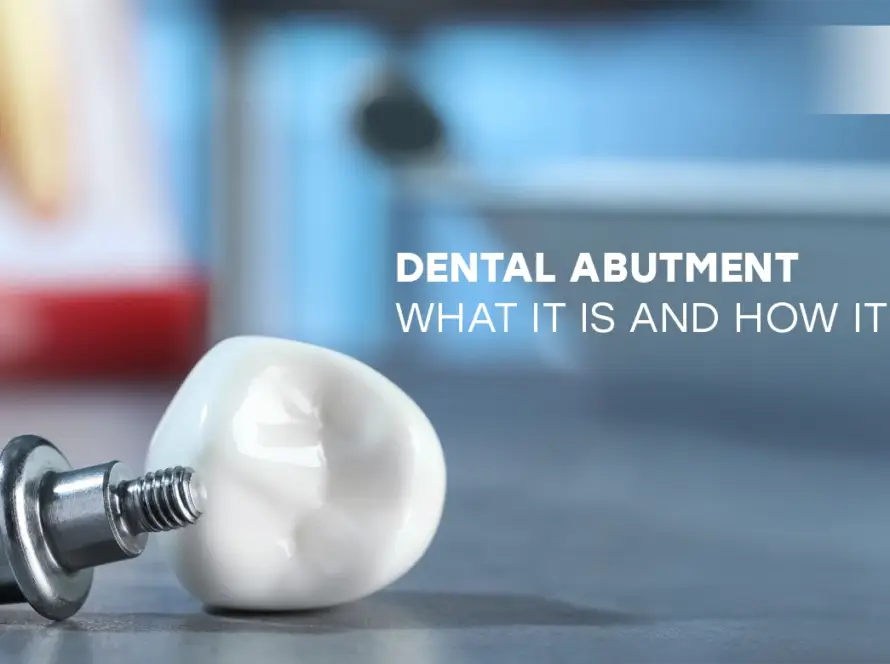 dental abutment