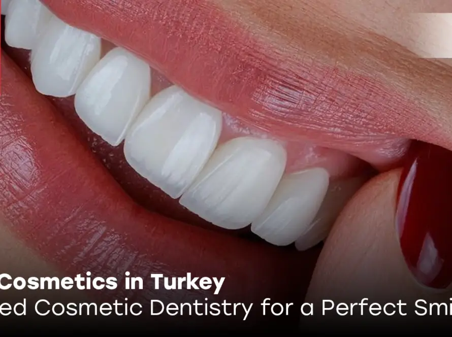 Dental cosmetics Turkey
