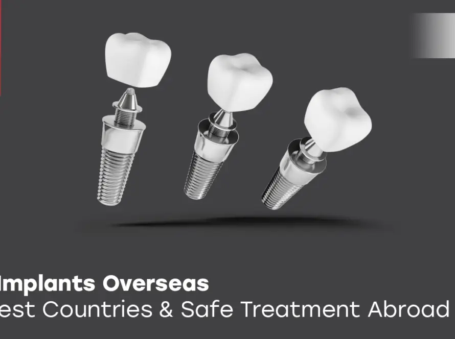 Dental Implants Overseas