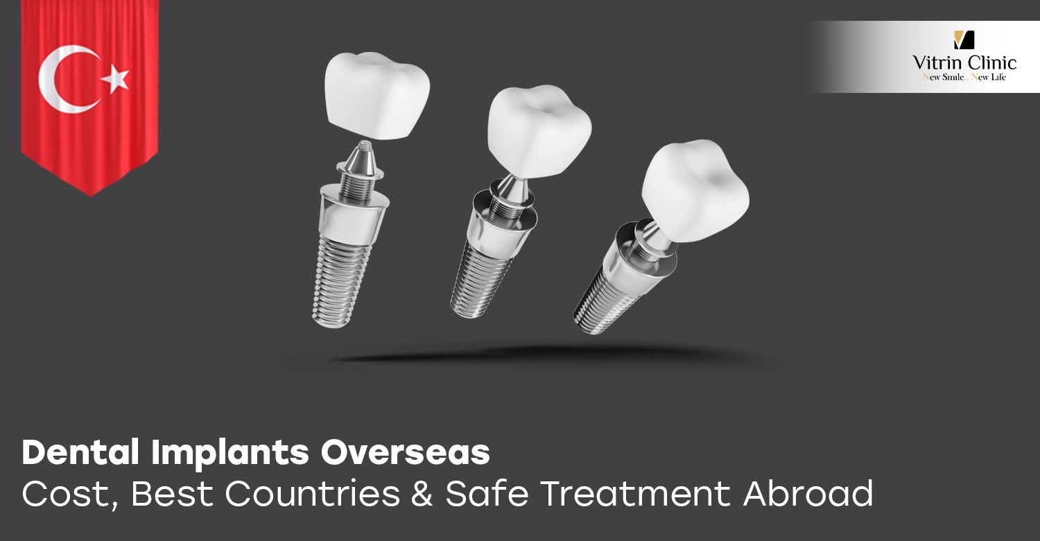 Dental Implants Overseas