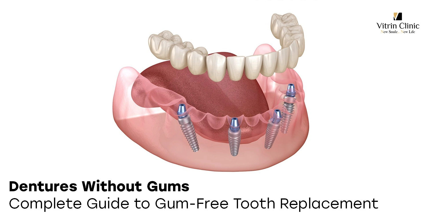Dentures without gums