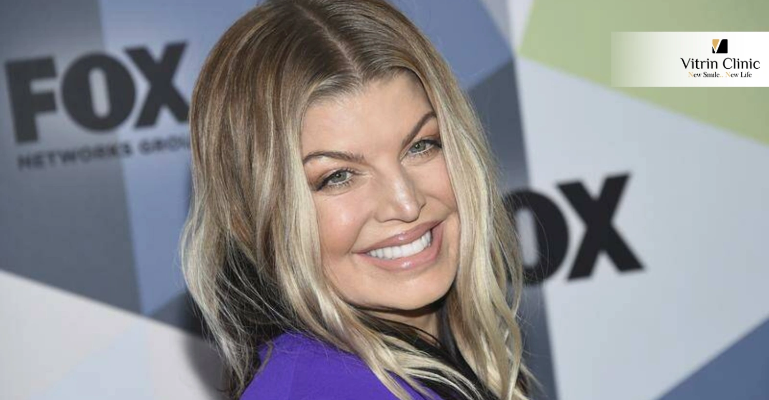 Fergie smile