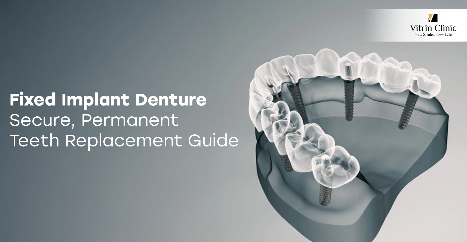Fixed Implant Denture
