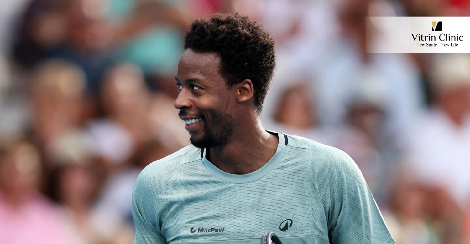 Gardez l'éclat de Gaël Monfils : Secrets d'un sourire de qualité star