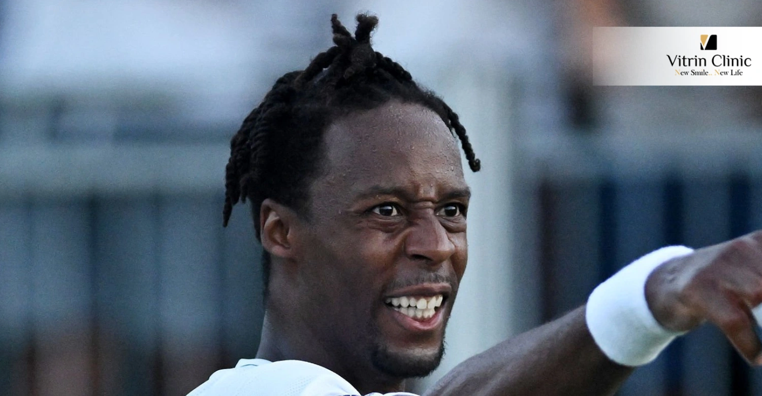 Transformation du sourire de Gaël Monfils : Avant, après et tout ce qui se trouve entre les deux