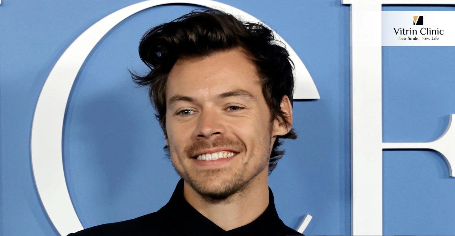 Harry Styles smile