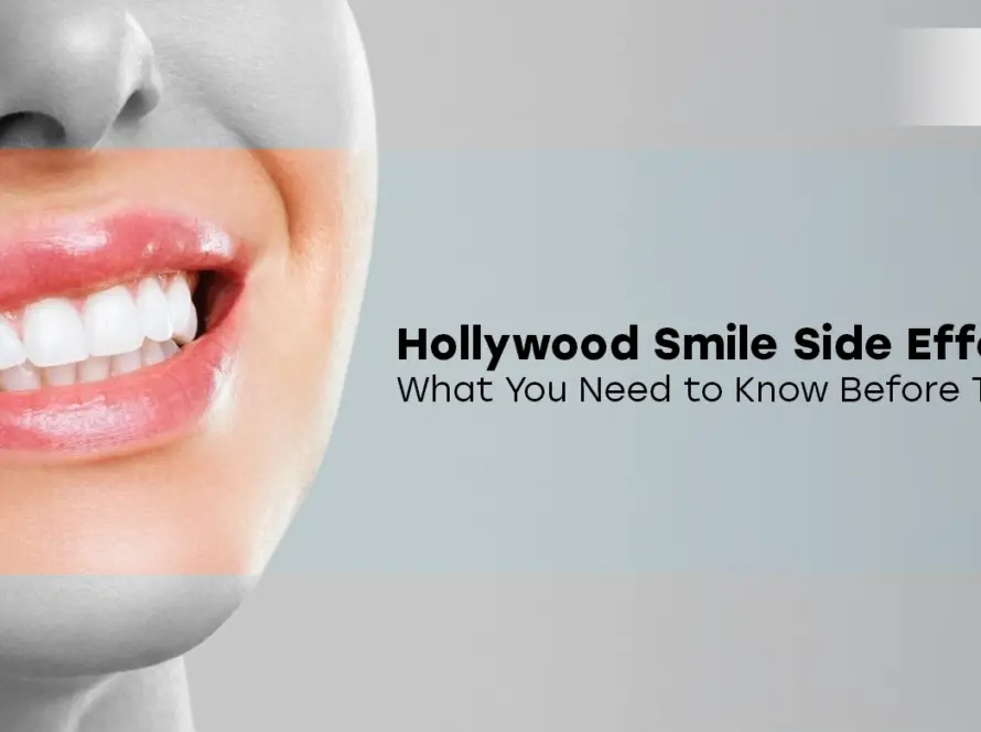 Hollywood Smile Side Effects
