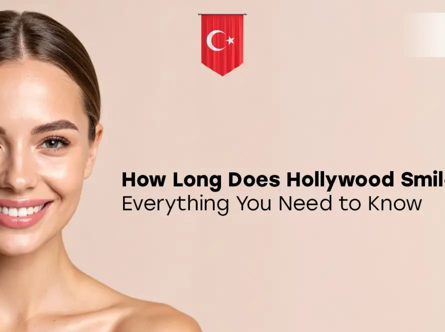 how long does hollywood smile last