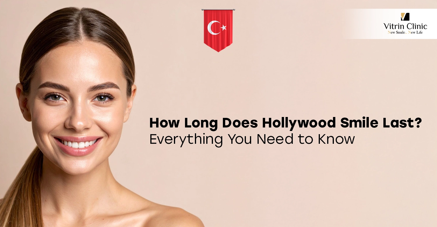 how long does hollywood smile last