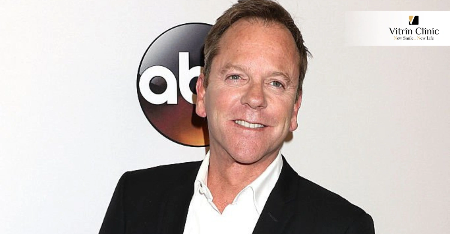 Kiefer Sutherland Smile