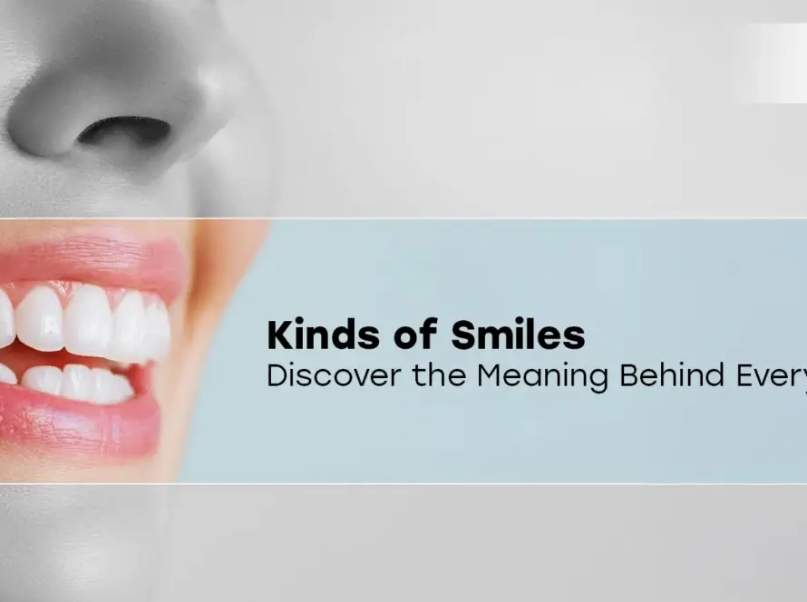 Kinds of Smiles