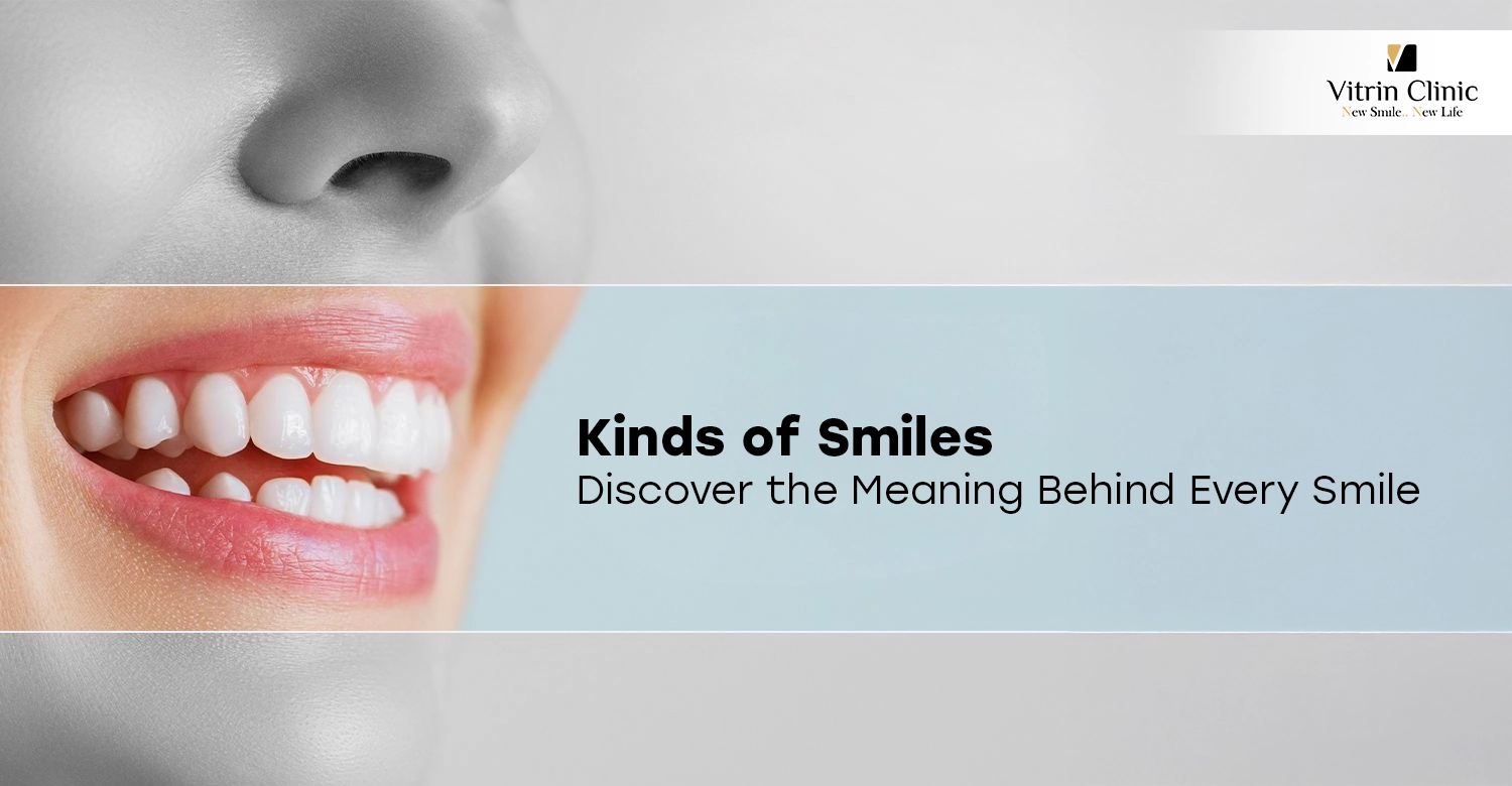 Kinds of Smiles