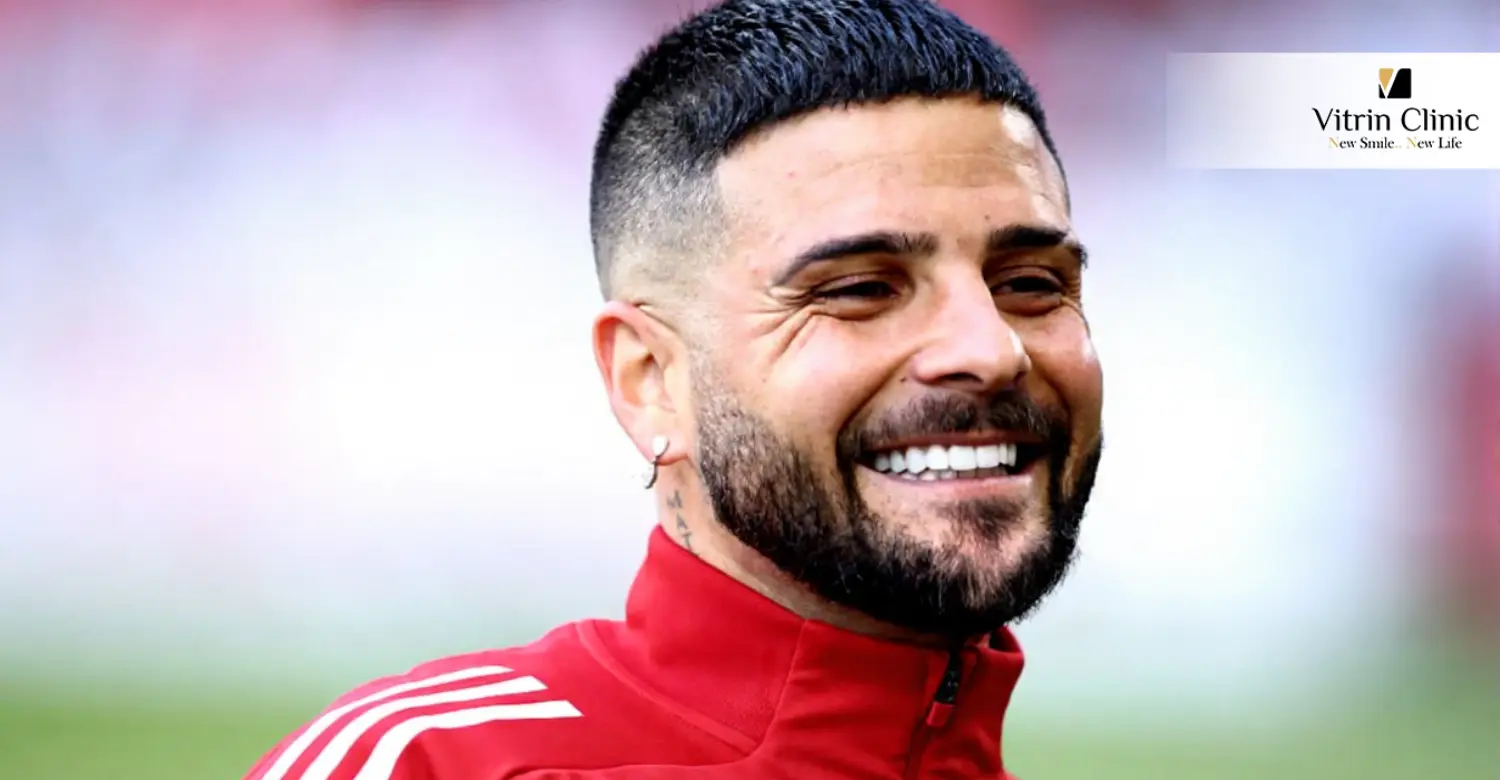 Sorriso di Lorenzo Insigne