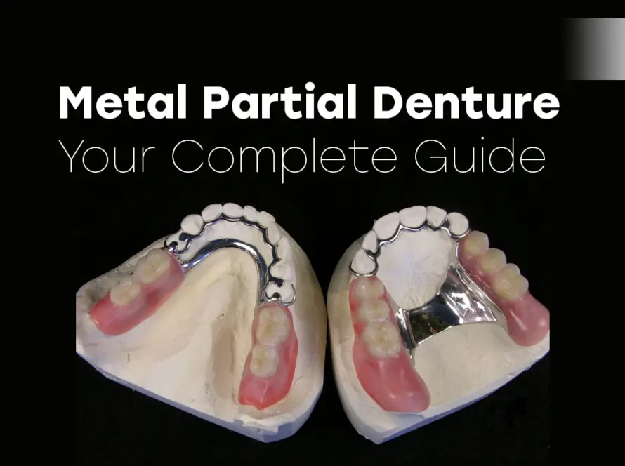 Metal Partial Denture