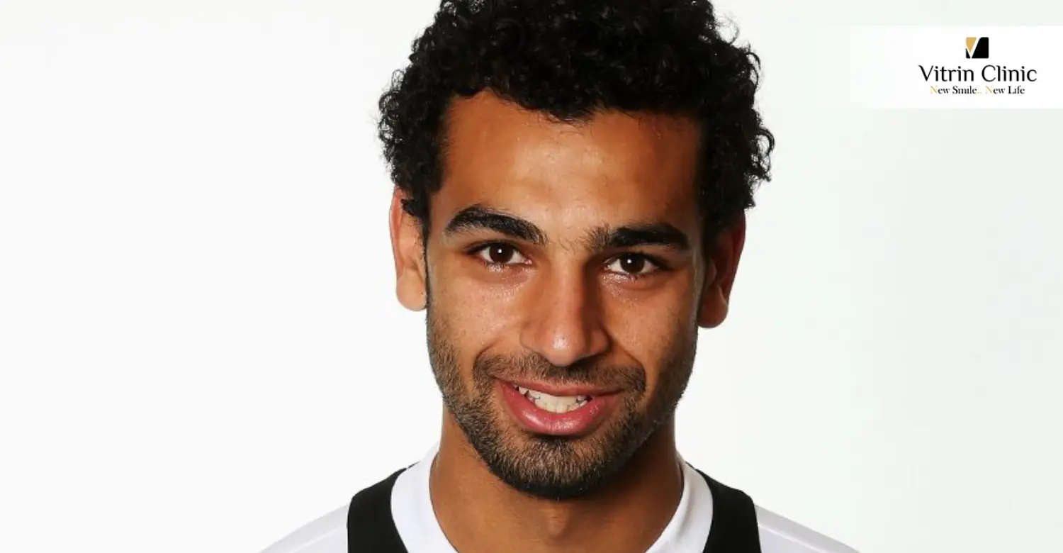 Mohamed Salah's Teeth in 2012