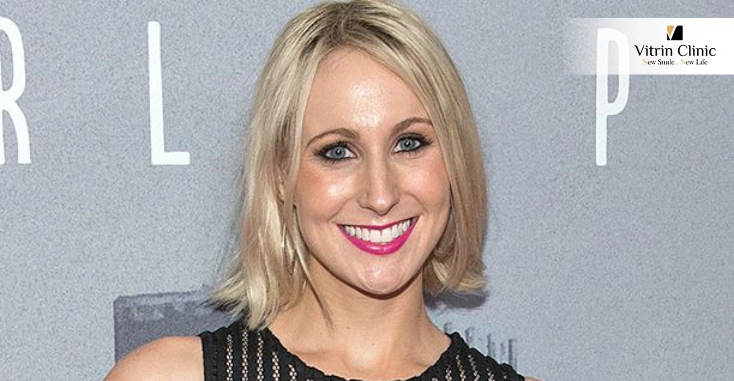 Nikki Glaser Teeth in 2016