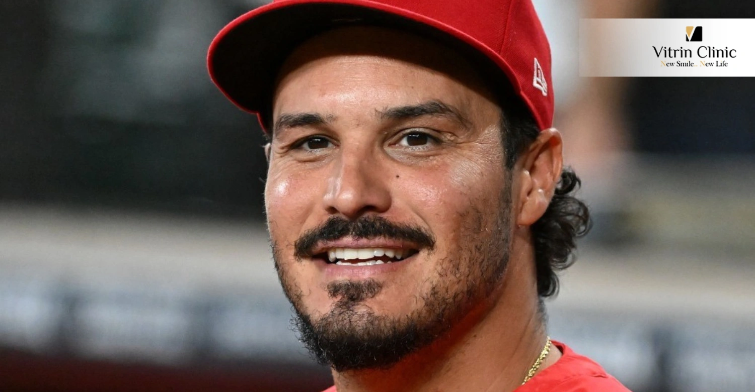 Nolan Arenado smile