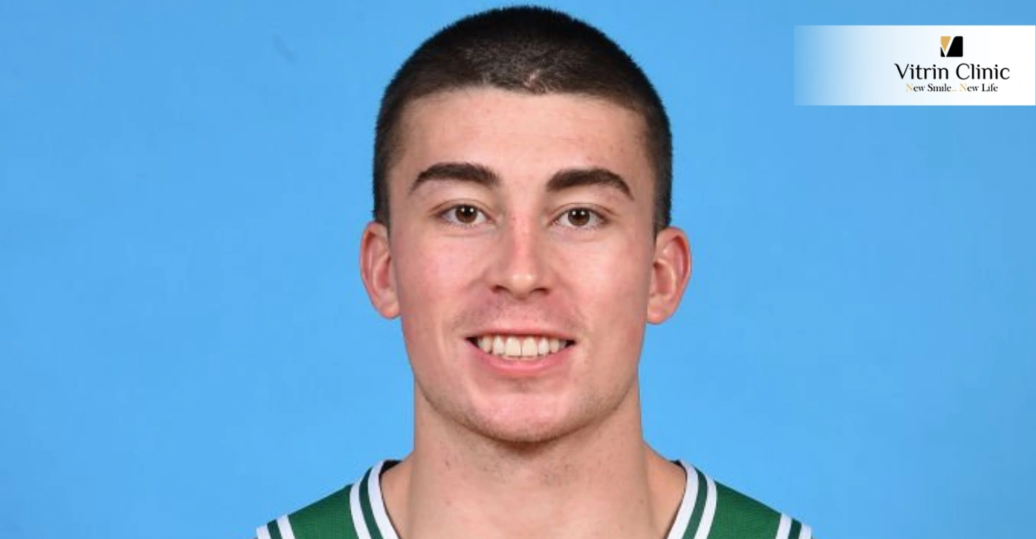 Payton Pritchard teeth