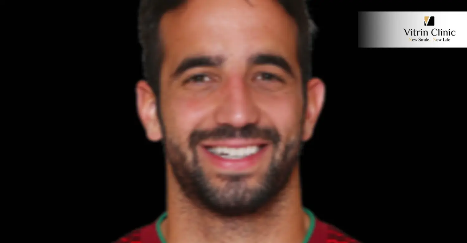Ruben Amorim Teeth in 2016