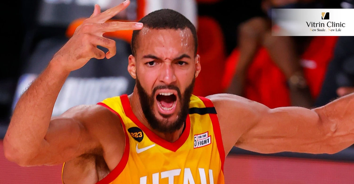 Rudy Gobert teeth