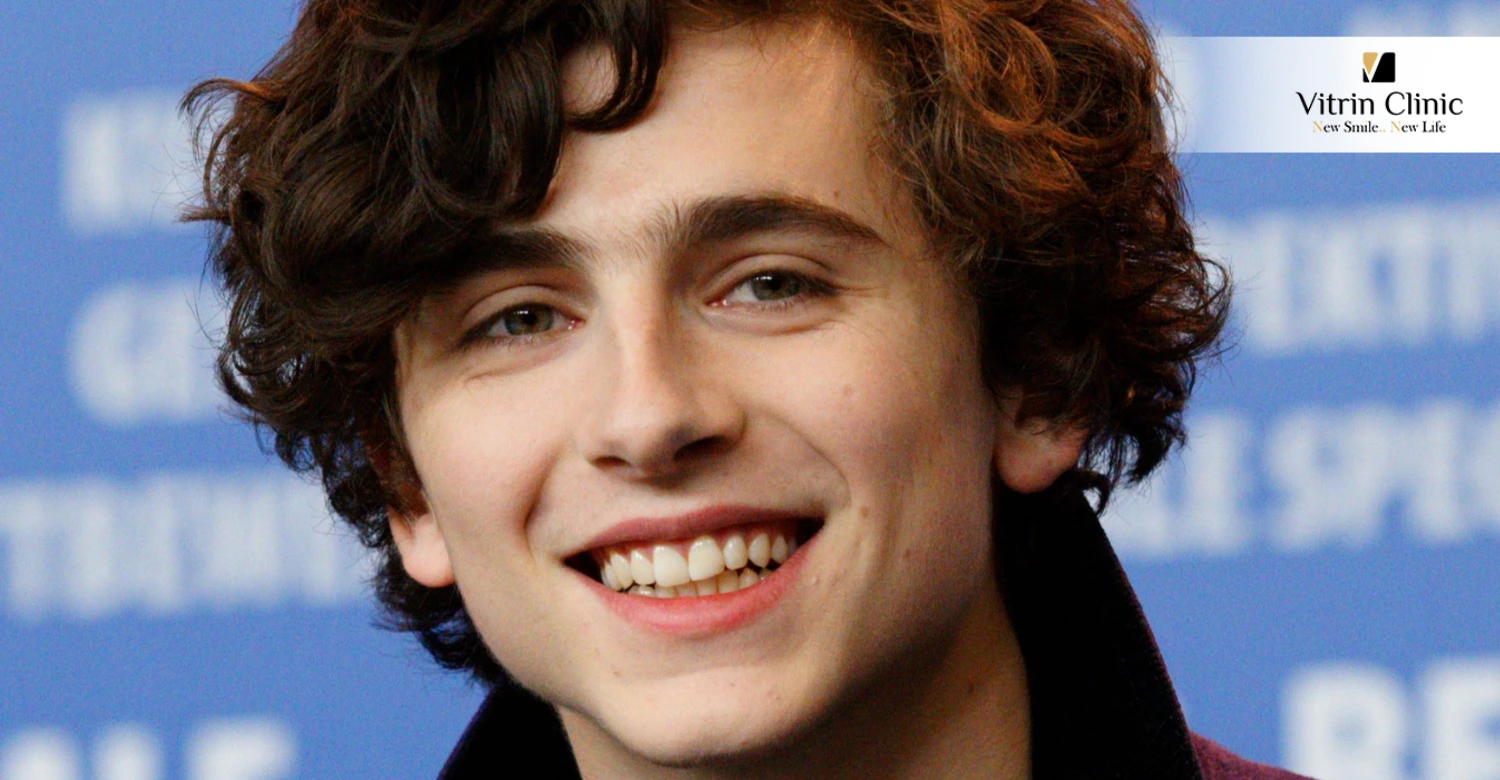 Timothée Chalamet Teeth in 2022