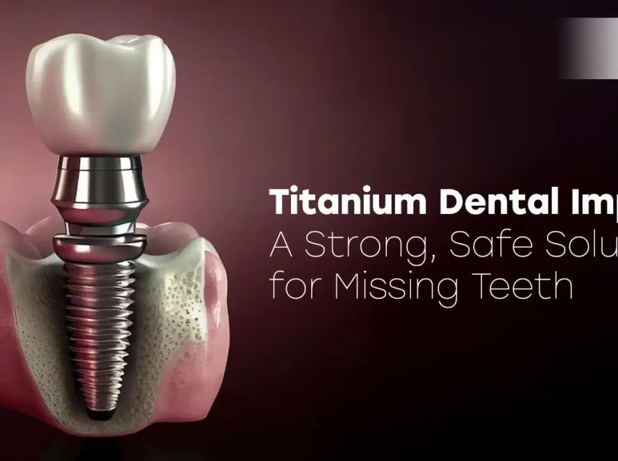 Titanium Dental Implants