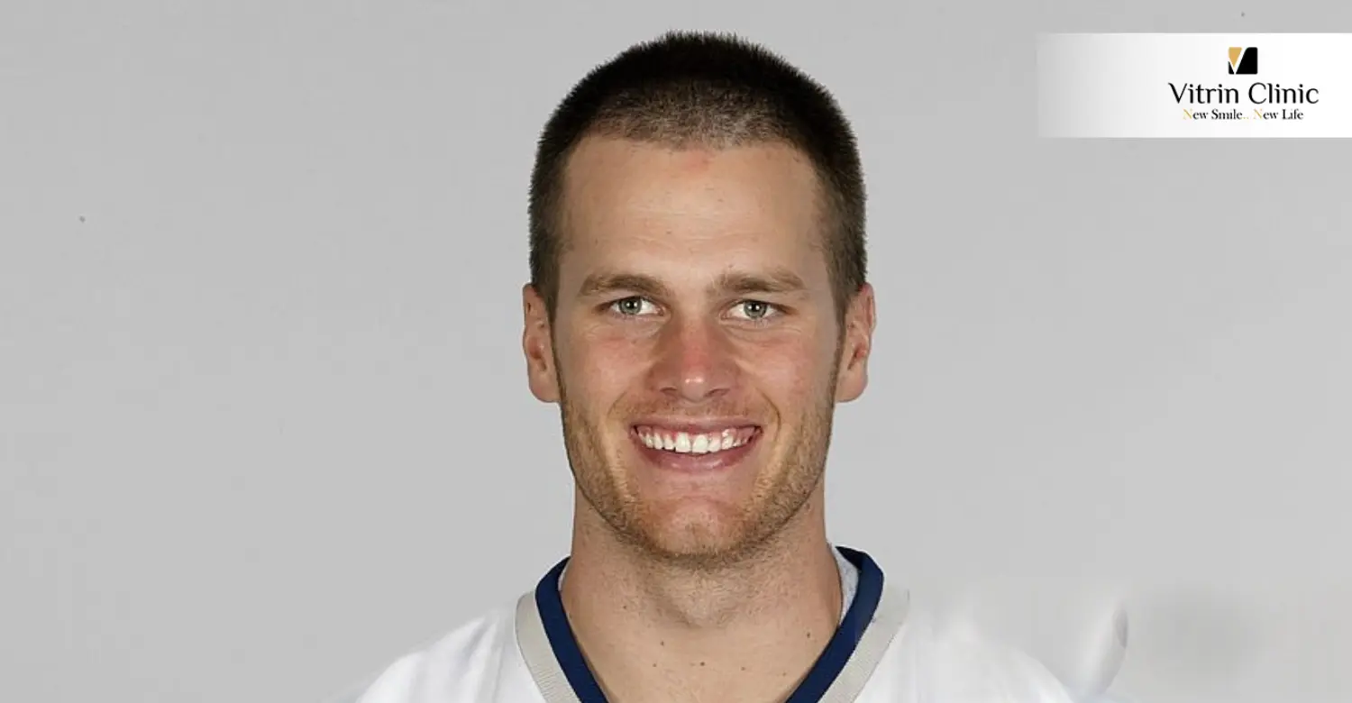 Tom Brady Smile Transformation Over the Years