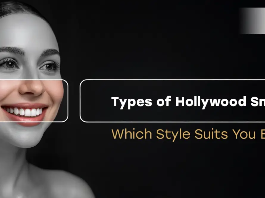 Types of Hollywood Smile: Which Style Suits You Best?
