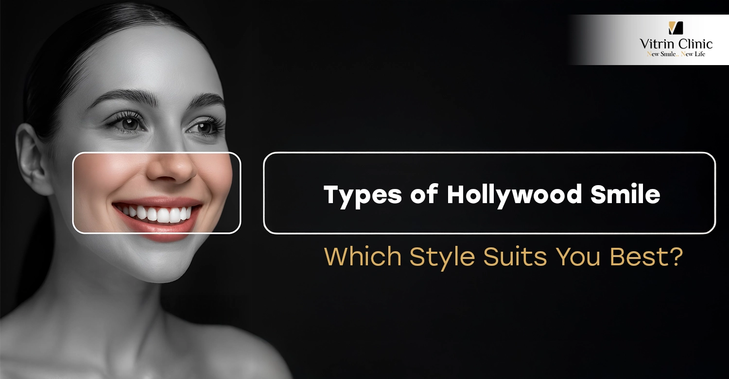 Types of Hollywood Smile: Which Style Suits You Best?