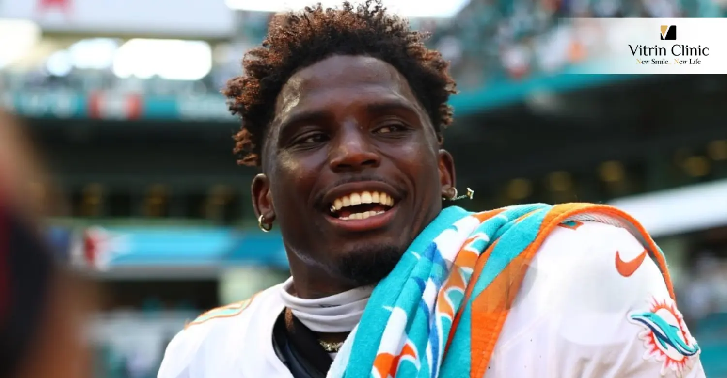 Tyreek Hill smile