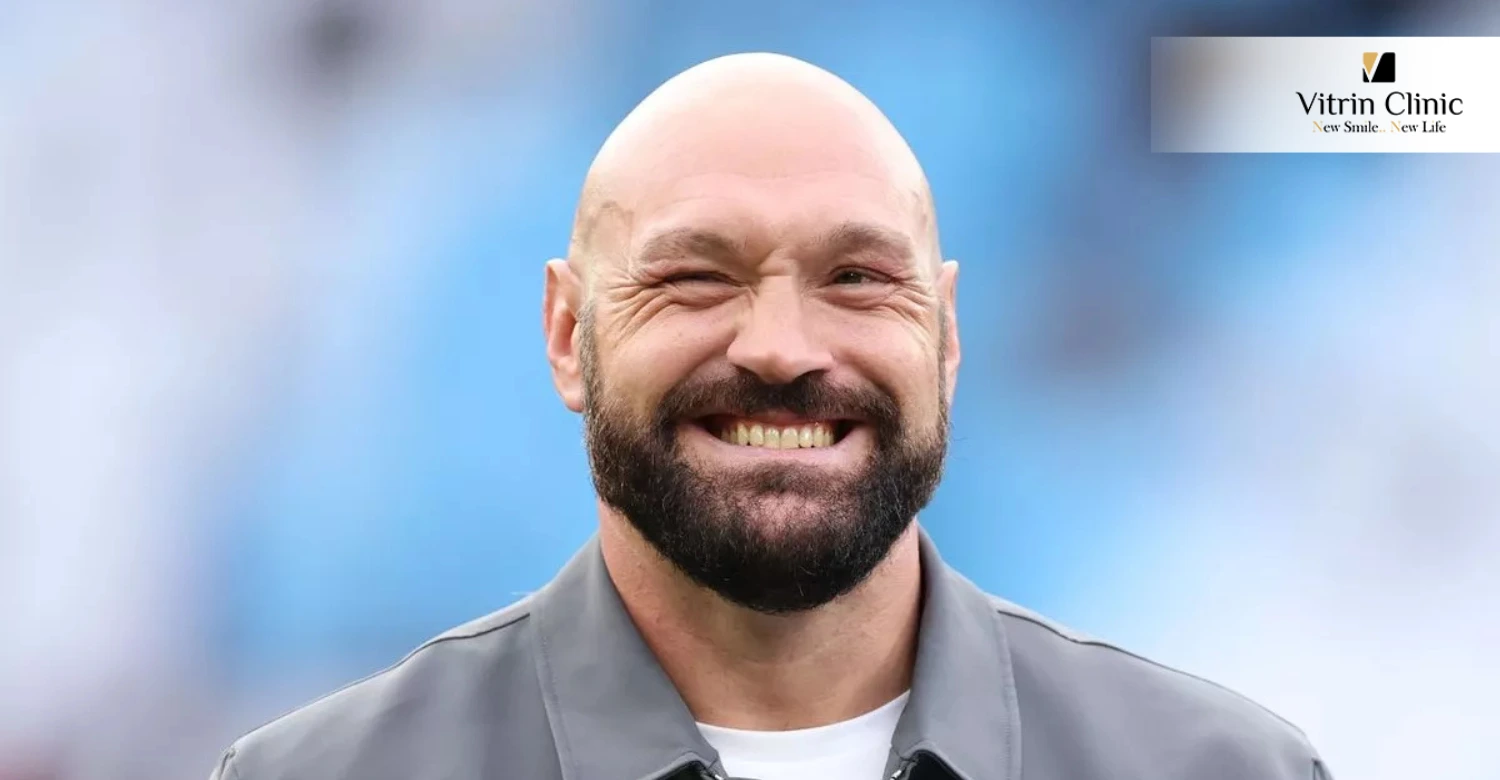 Tyson Fury teeth