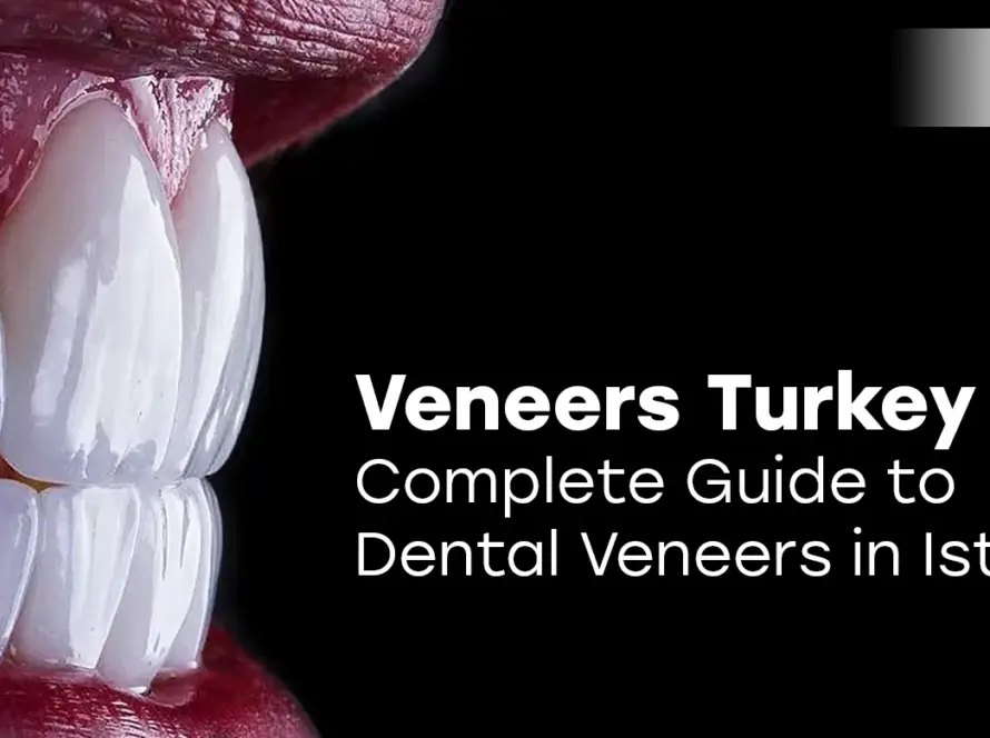 Veneers Turkey