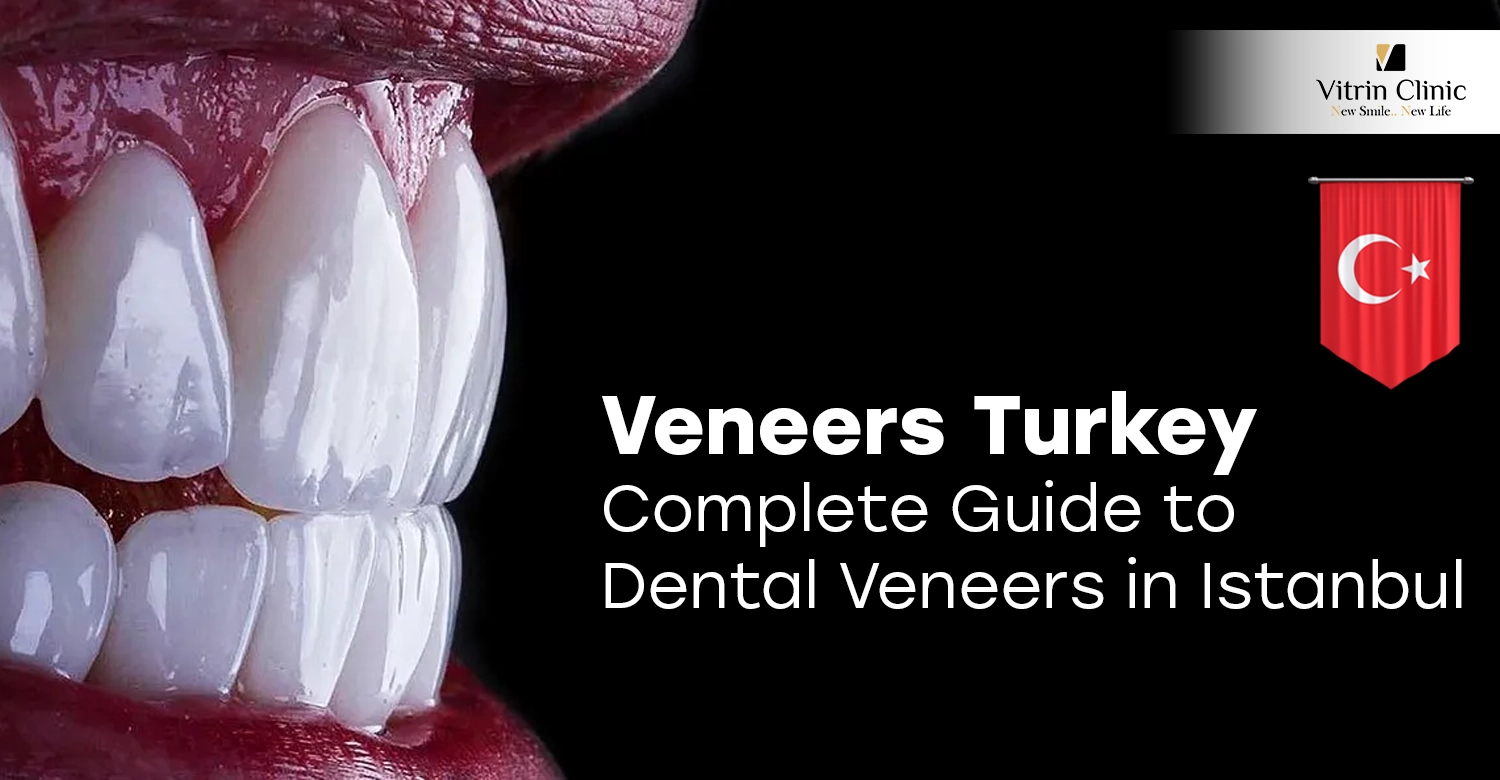 Veneers Turkey