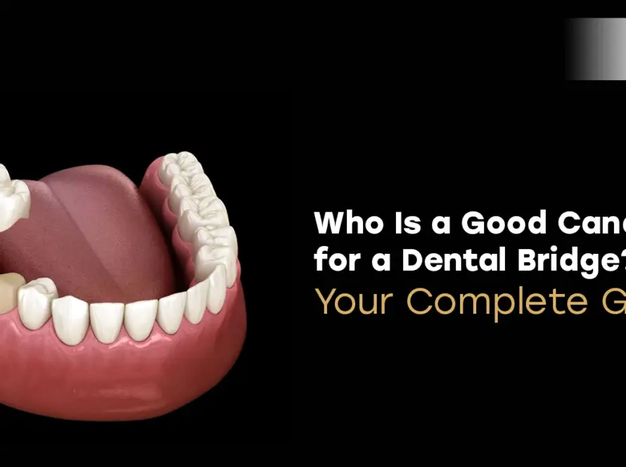 Who Is a Good Candidate for a Dental Bridge