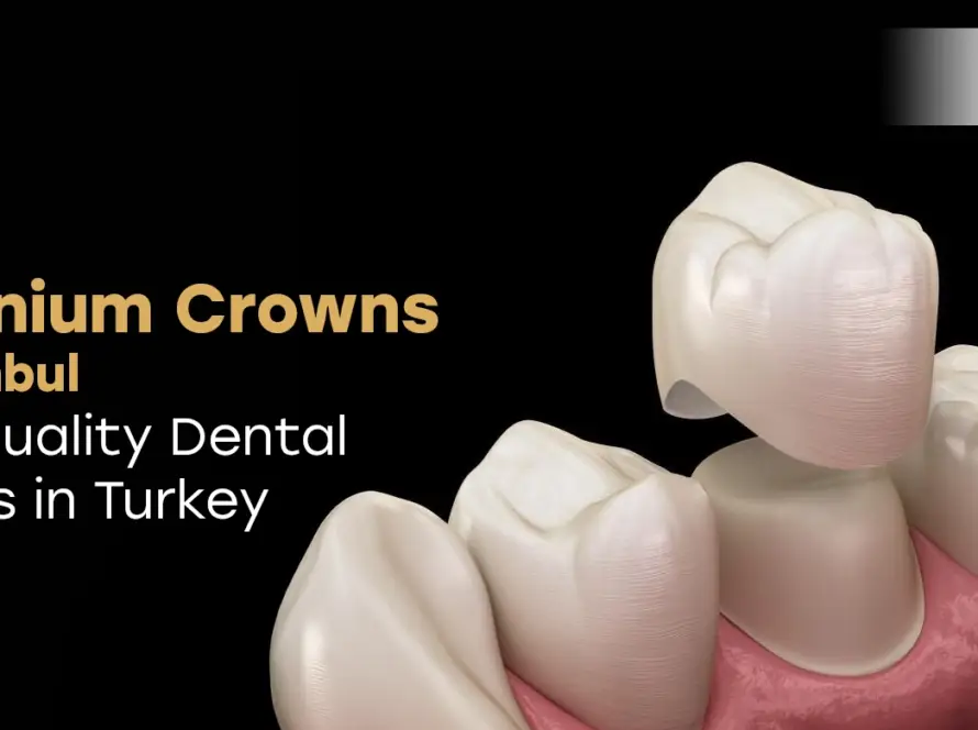Zirconium Crowns in Istanbul