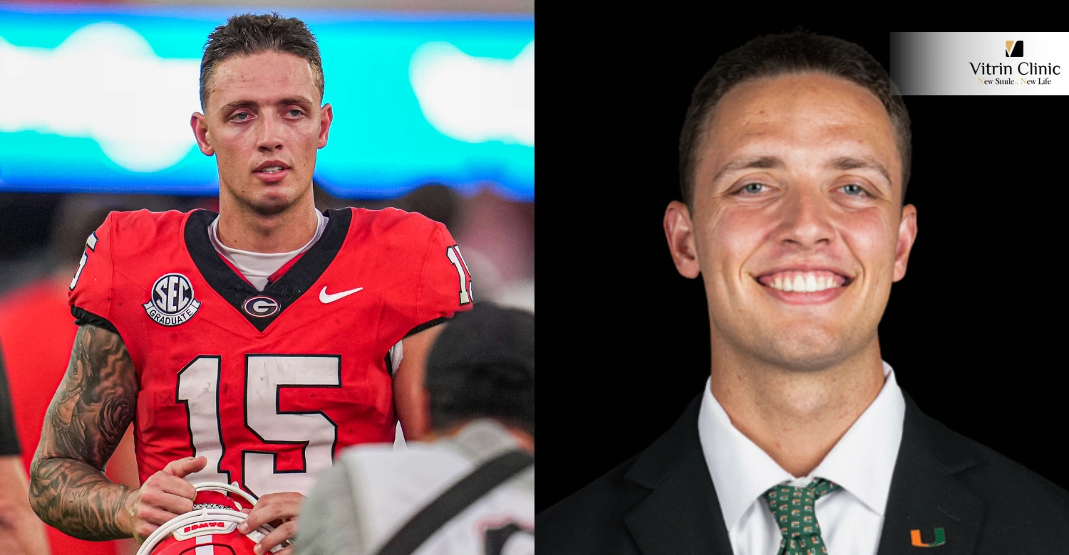 Carson Beck Teeth Transformation