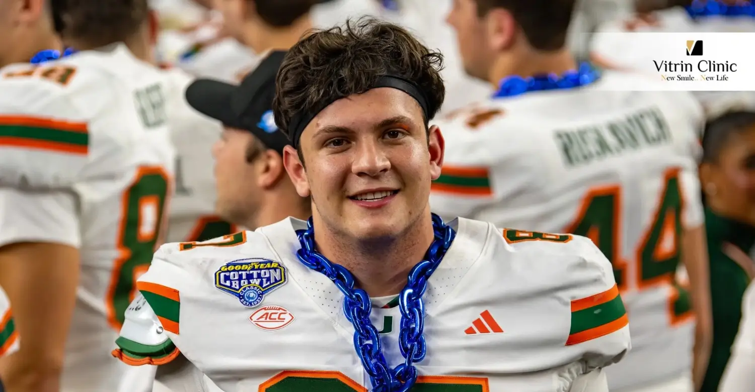 Alex Bauman Smile