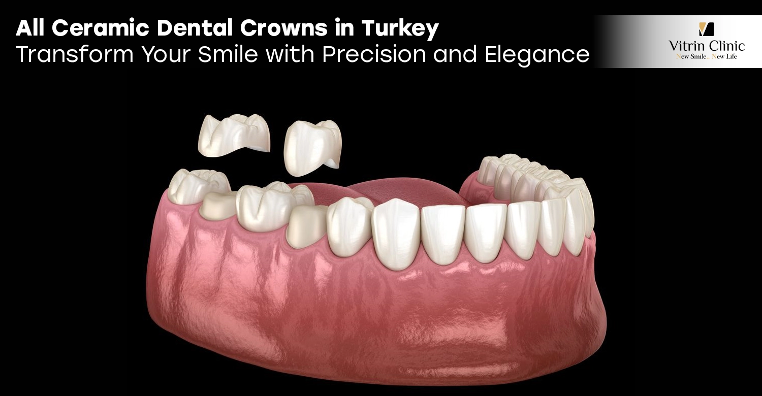All Ceramic Dental Crowns in Turkey