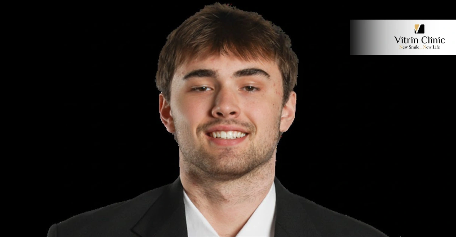 Andrew Depaepe Smile