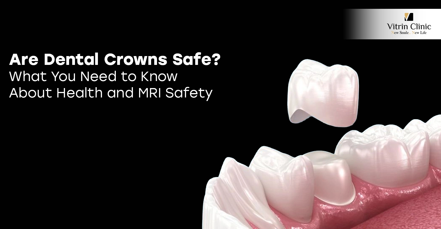 Are Dental Crowns Safe