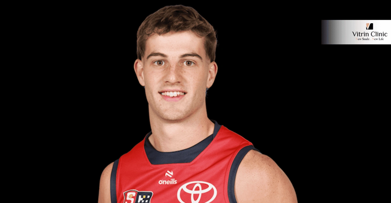 Billy Dowling Smile