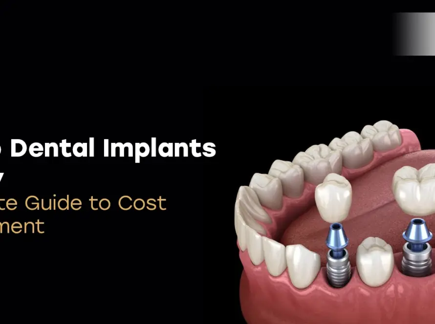 Cheap Dental Implants Turkey
