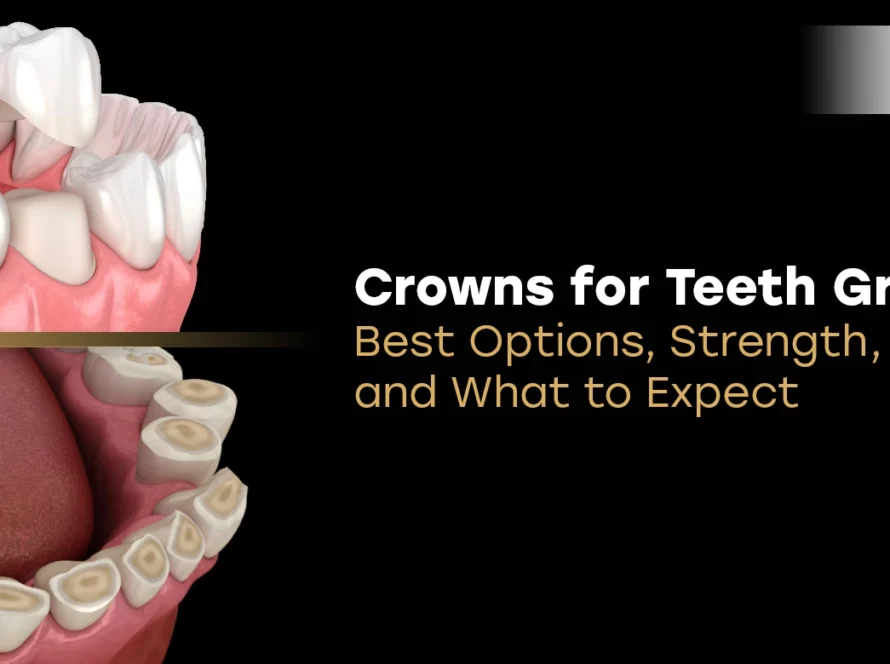 Crowns for Teeth Grinding