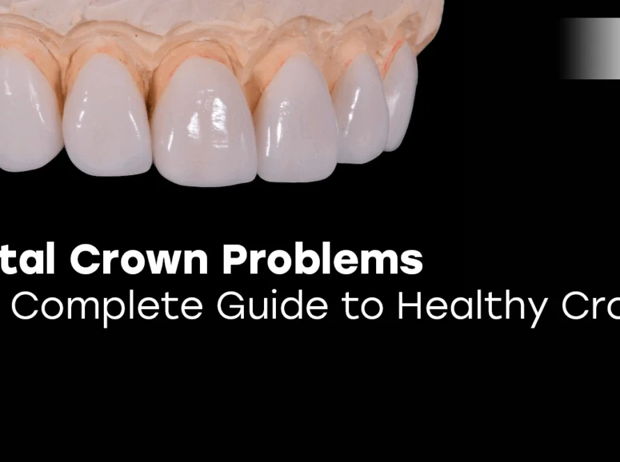 Dental Crown Problems
