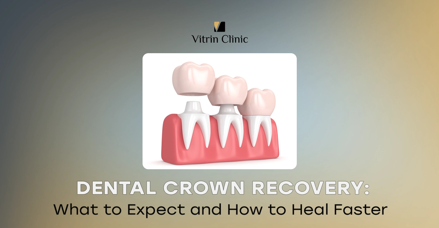 Dental Crown Recovery